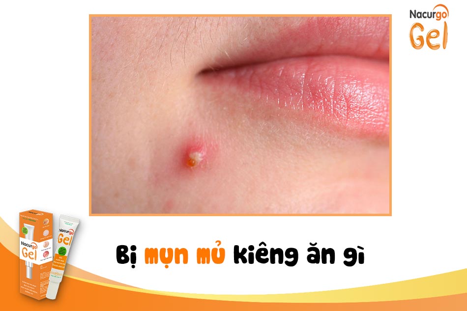 Bị mụn mủ kiêng ăn gì