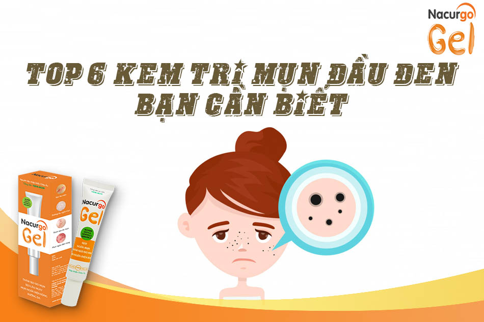 Top 6 kem trị mụn đầu đen hiệu quả