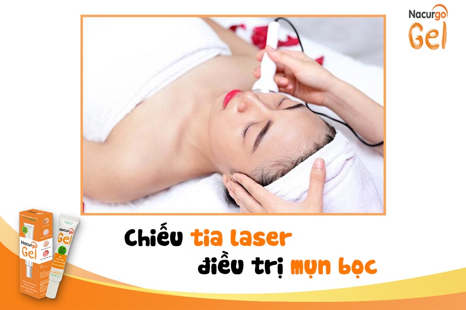 Trị mụn bằng chiếu tia laser