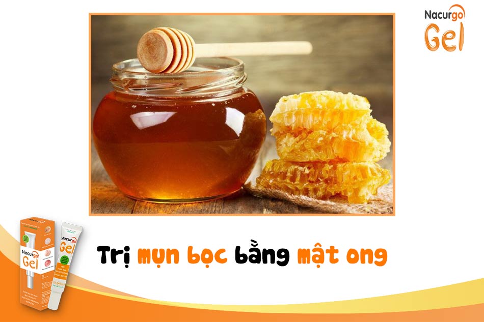 Trị mụn bọc trên trán bằng mật ong