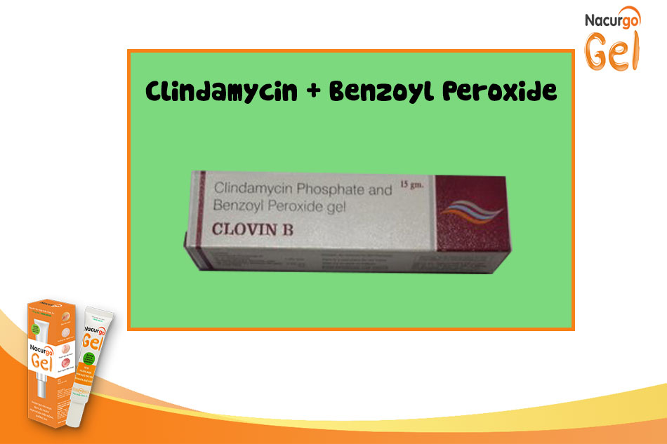 Kết hợp điều trị clindamycin và Benzoyl Peroxide