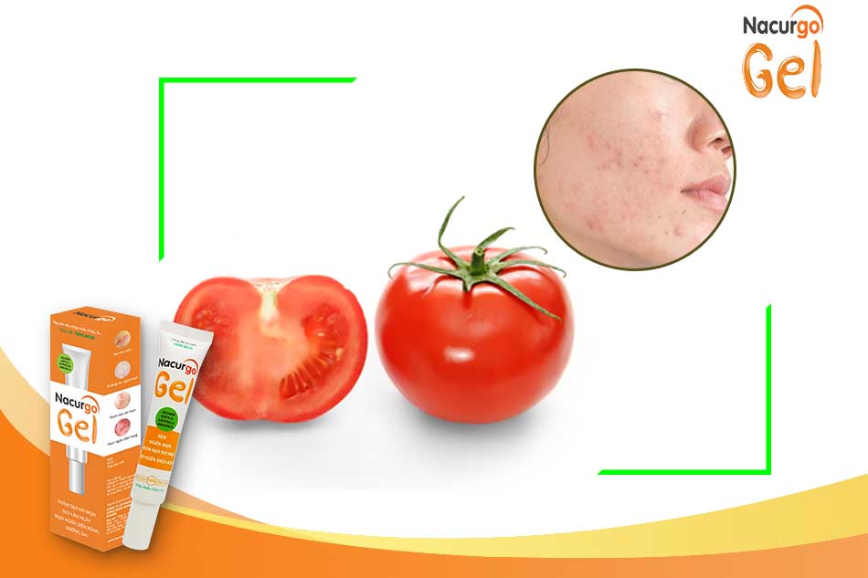 Cách dùng cà chua trị mụn đầu đen