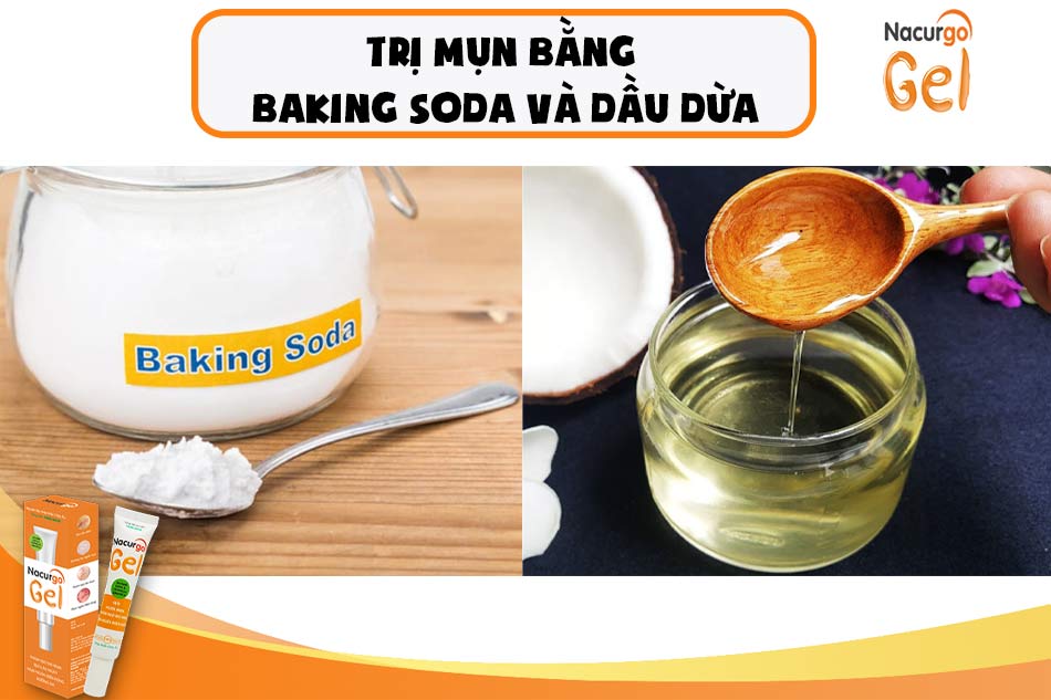 Mặt nạ trị mụn với dầu dừa và Baking soda