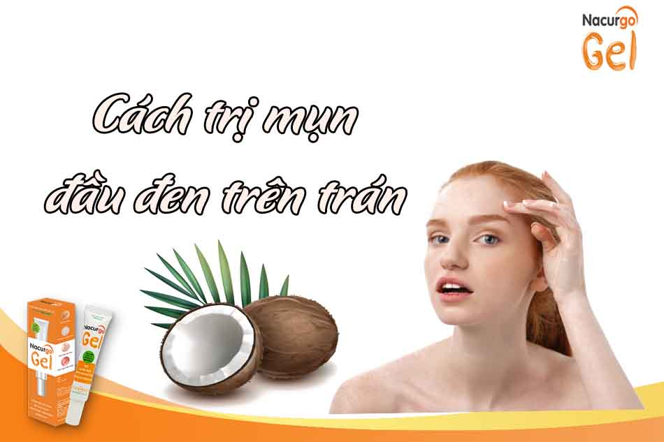 cách trị mụn đầu đen ở trán