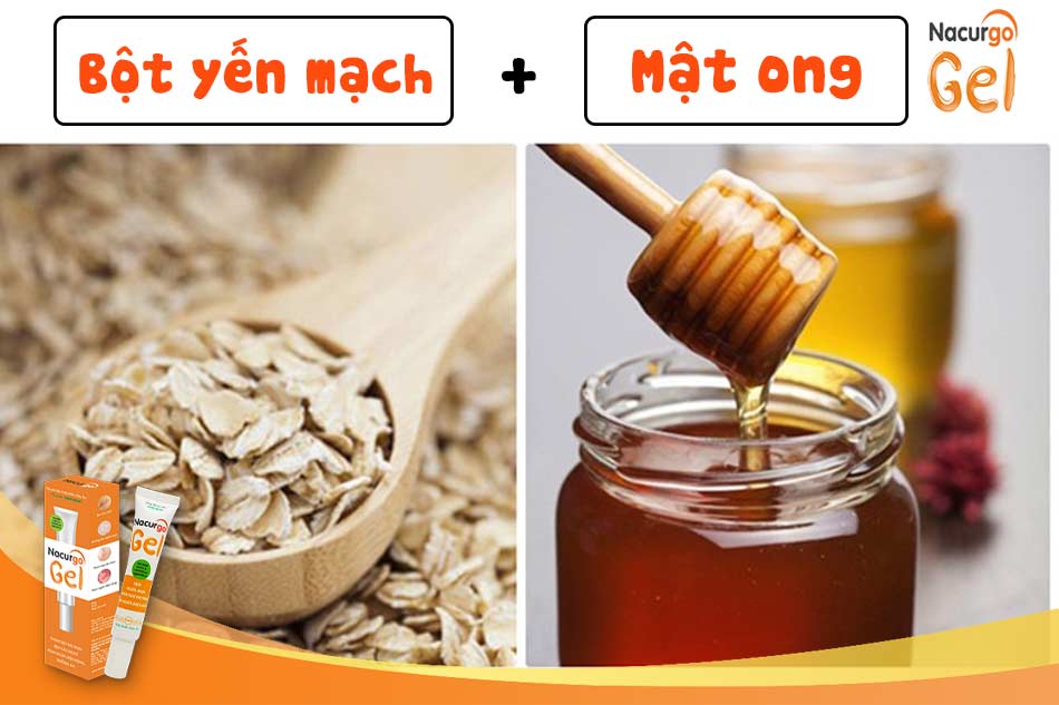 Cách trị mụn trứng cá bằng mật ong