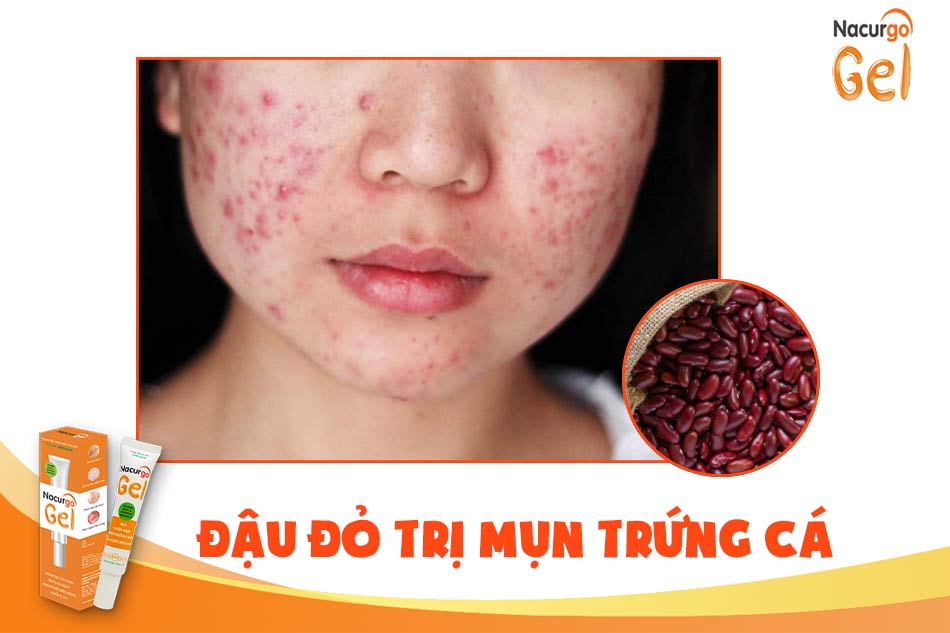 Tác dụng trị mụn trứng cá của đậu đỏ