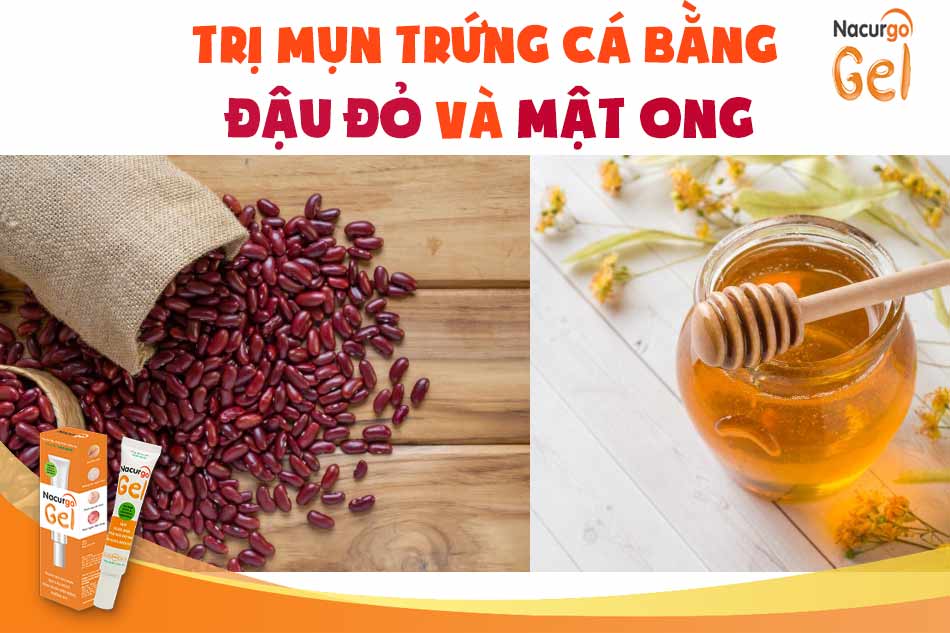 Trị mụn trứng cá bằng đậu đỏ và mật ong