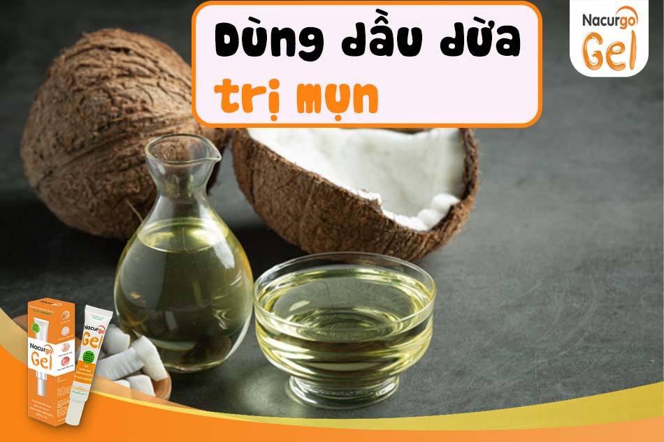 Có thể dùng dầu dừa trị mụn cho da nhờn không