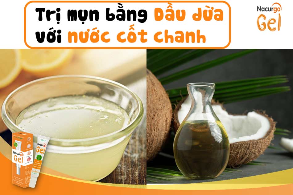 Bí quyết trị mụn bằng dầu dừa và nước cốt chanh