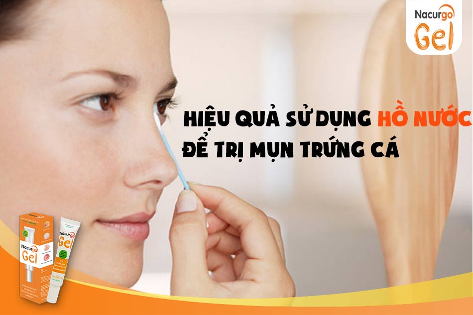 Hồ nước trị mụn trứng cá