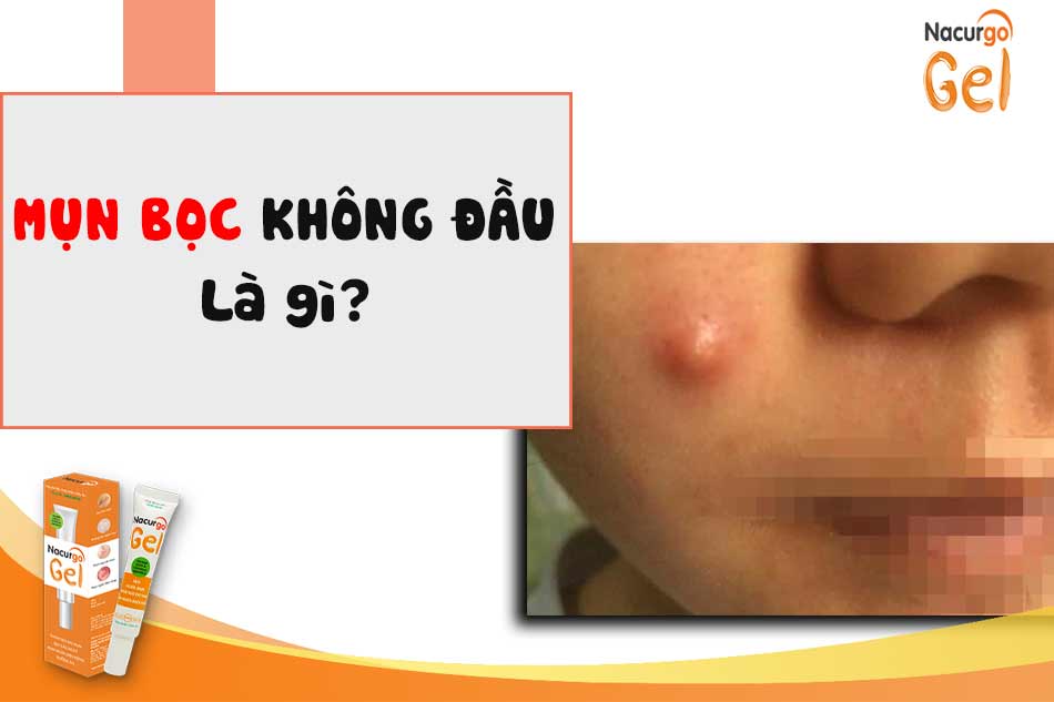 Mụn bọc không đầu