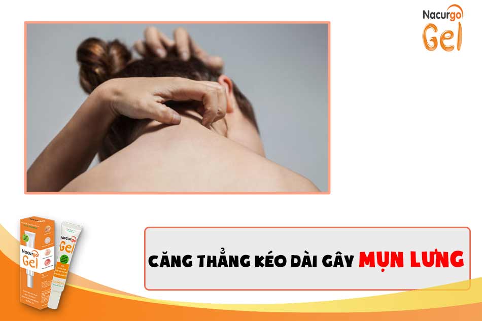 Căng thẳng kéo dài gây mụn trứng cá ở lưng