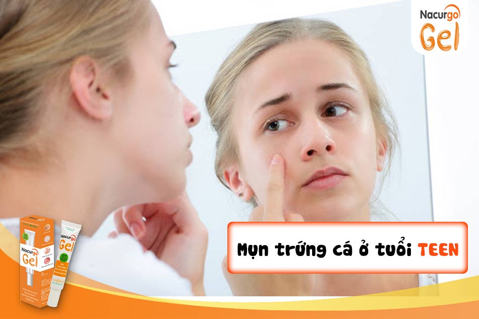 Mụn trứng cá ở tuổi dậy thì