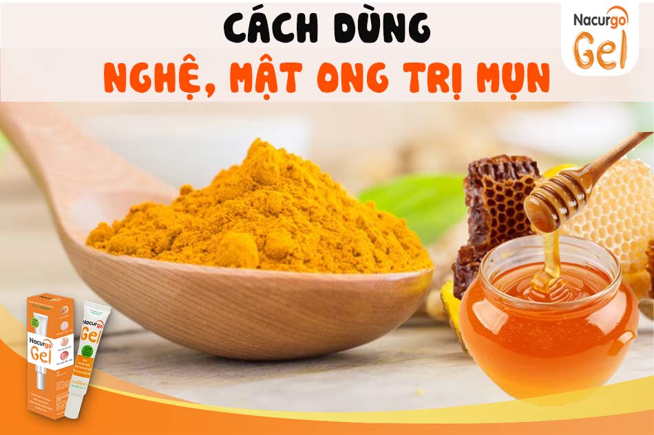 Cách sử dụng nghệ, mật ong trị mụn