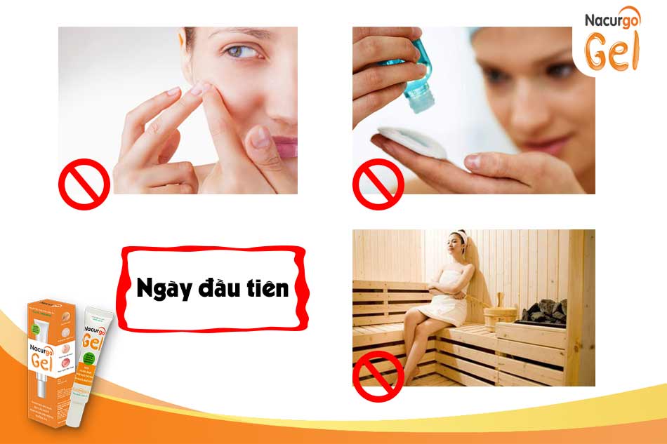 Sau khi nặn mụn nên làm gì?