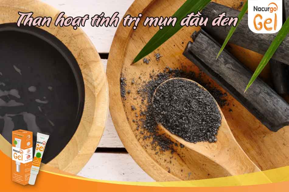 Than hoạt tính trị mụn đầu đen