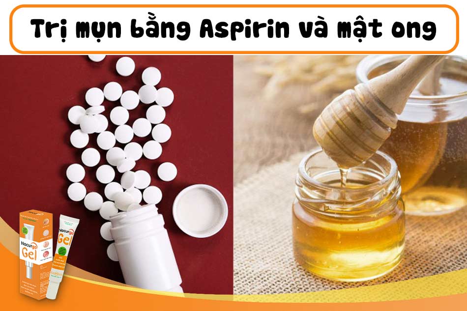 Trị mụn bọc với Aspirin và mật ong