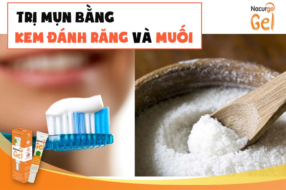 Kinh nghiệm trị mụn bằng kem đánh răng và muối