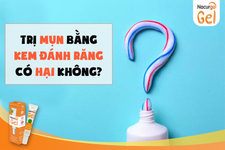 Trị mụn bằng kem đánh răng có hại không?