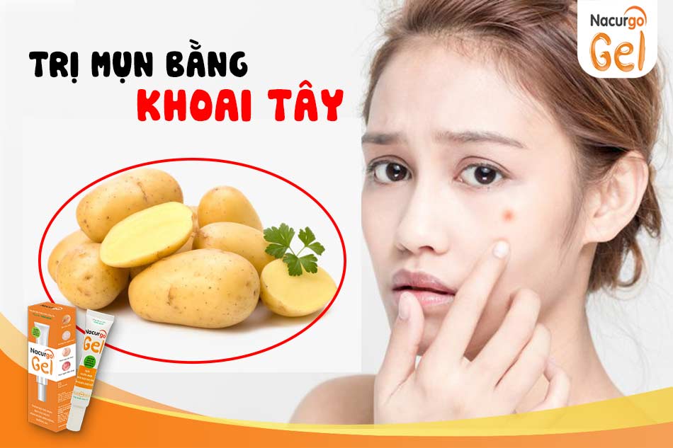 Trị mụn bằng khoai tây