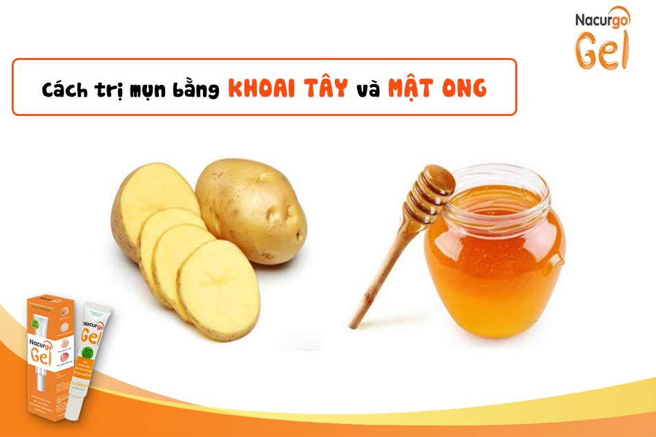 Trị mụn bằng khoai tây