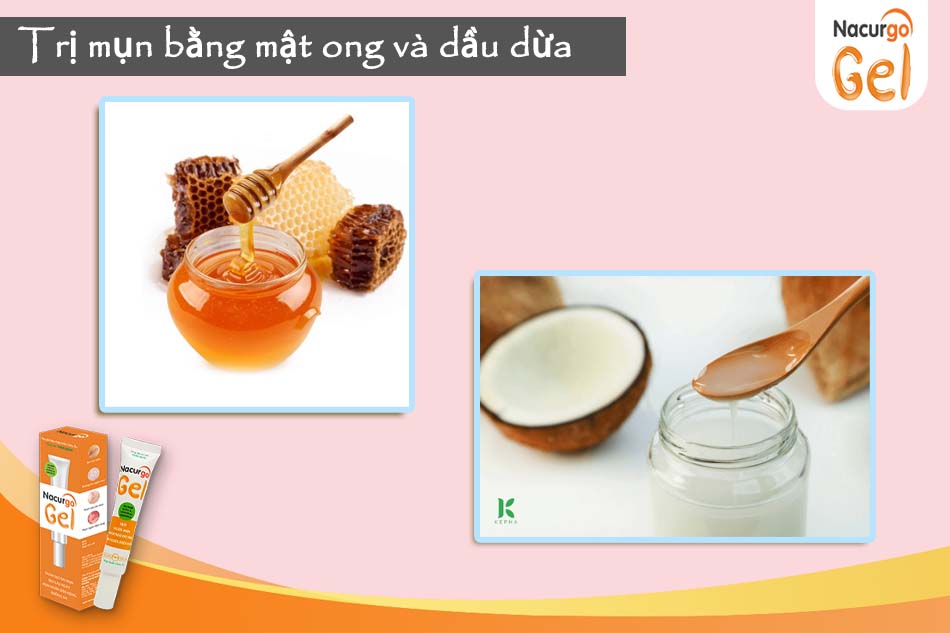 Kết hợp trị mụn bằng mật ong và dầu dừa