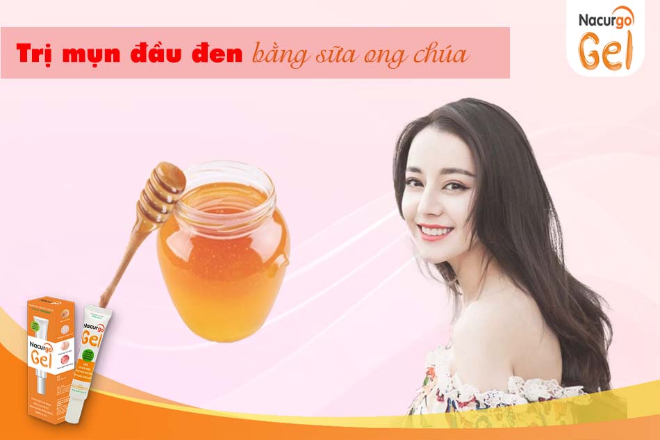 Trị mụn đầu đen bằng sữa ong chúa