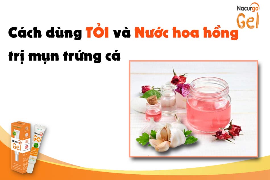 Trị mụn trứng cá bằng tỏi