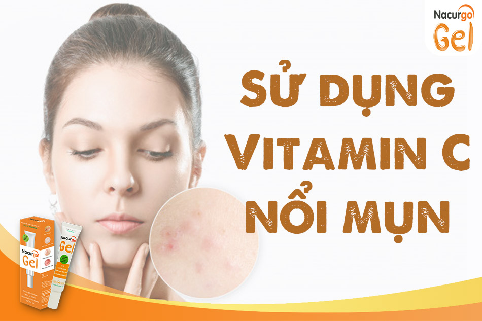 Dùng serum vitamin C bị nổi mụn