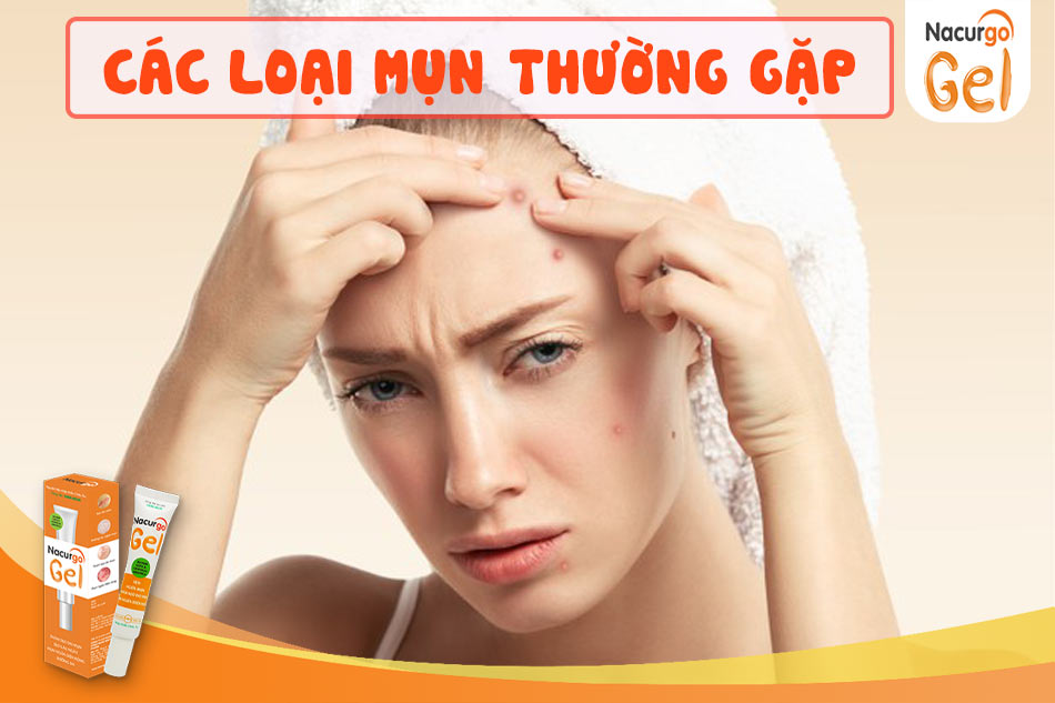 Các loại mụn thường gặp