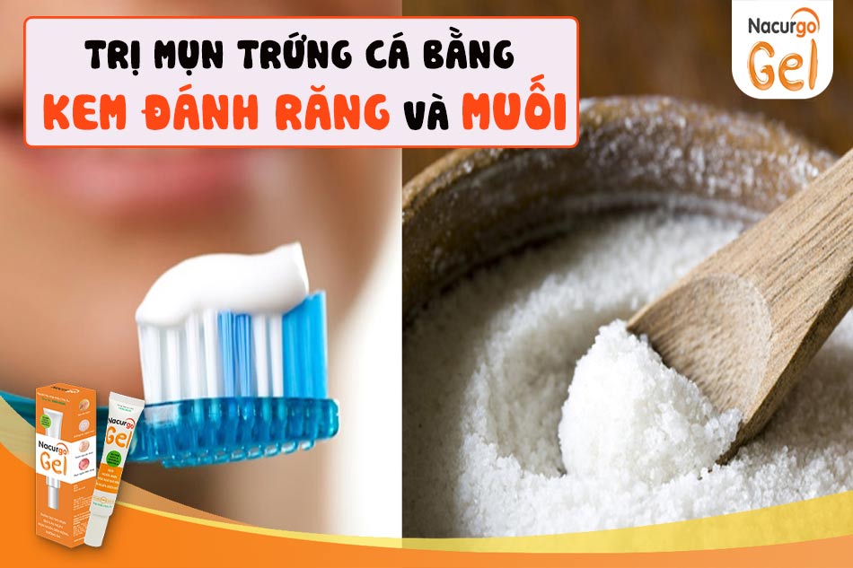 Trị mụn trứng cá bằng kem đánh răng và muối