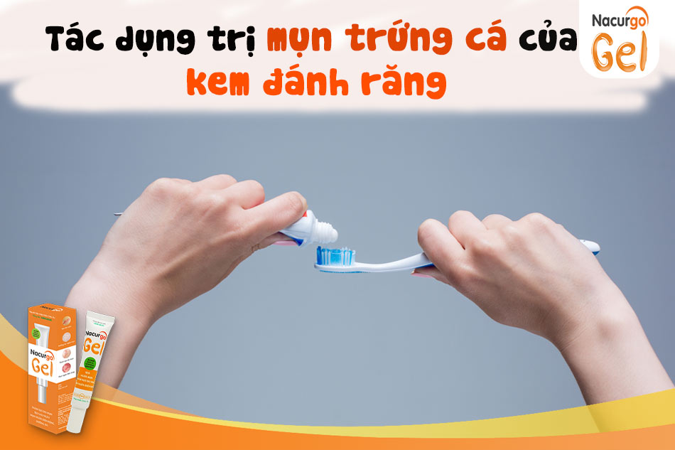 Tác dụng trị mụn trứng cá của kem đánh răng