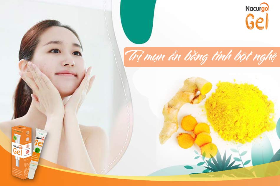 Mụn ẩn