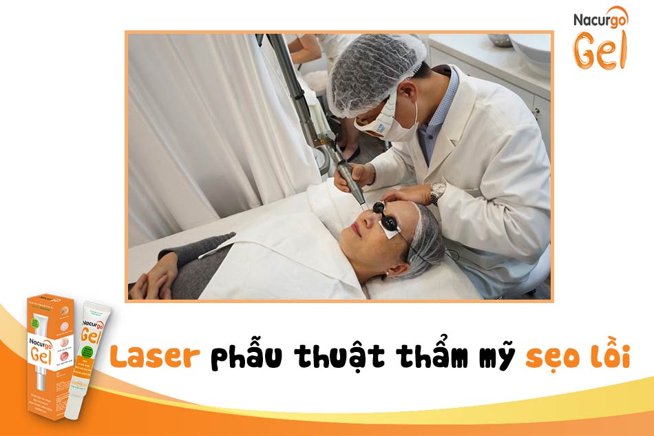 Phẫu thuật thẩm mỹ sẹo lồi với sóng laser áp dụng đối với những vết sẹo lồi