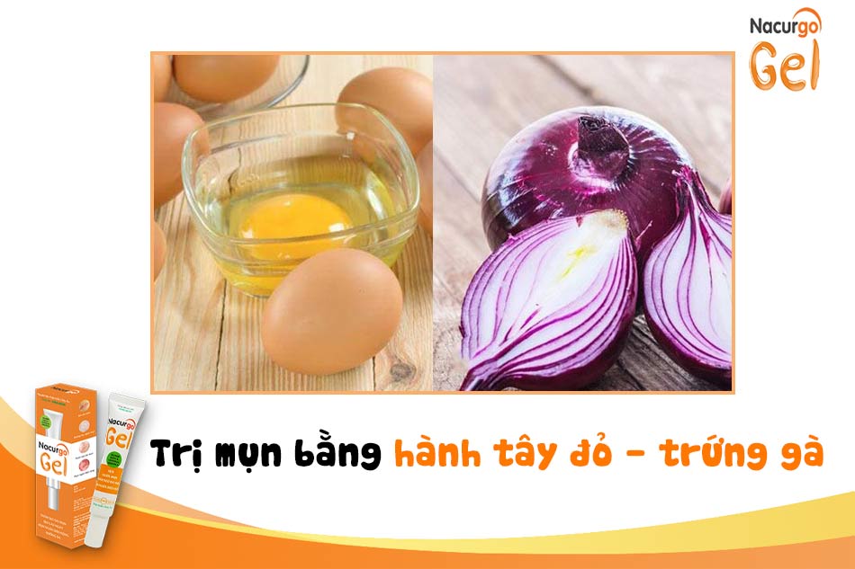 Hành tây đỏ - trứng gà sạch da, trị mụn hiệu quả