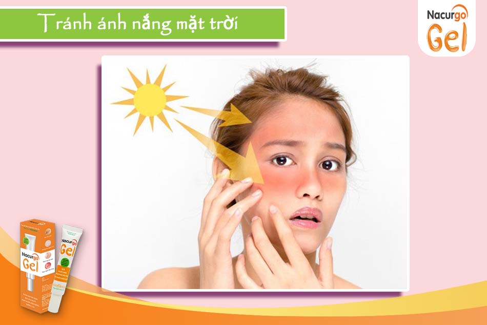Cần tránh ánh nắng mặt trời để bảo vệ da