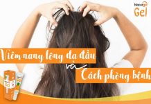 Viêm nang lông da đầu là gì và cách phòng ngừa