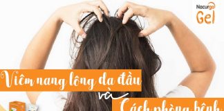 Viêm nang lông da đầu là gì và cách phòng ngừa