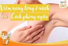 Viêm nang lông ở nách là gì và cách phòng ngừa?